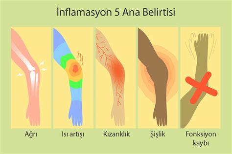 İnflamasyon - Yangı - İltihaplanma nedir? | Prof. Dr. Mustafa ÖZDOĞAN (2022)