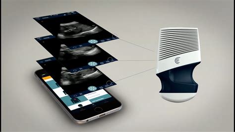 Clarius: Revolutionary Wireless Ultrasound Scanner - YouTube