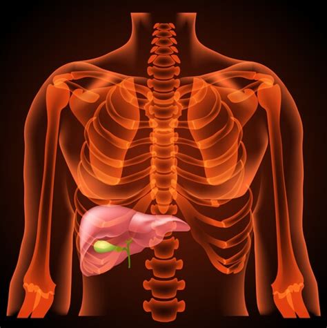 Complications after Gall bladder surgery