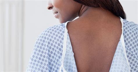 Black Patients Have the Worst Skin-Cancer-Survival Rates