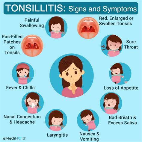 How Is Tonsillitis Diagnosed and Treated? - eMediHealth