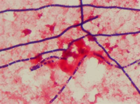 Gram stain of B. anthracis, showing large gram-positive | Open-i