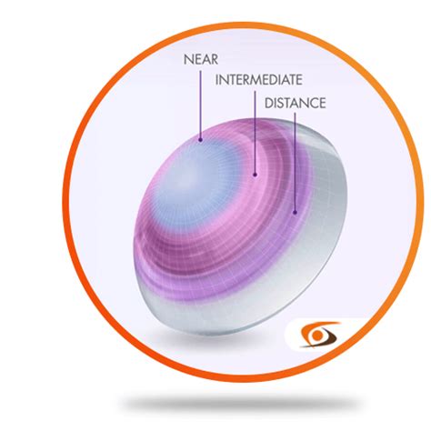 Bifocal Or Multifocal - Which Contact Lenses Are Right For You?