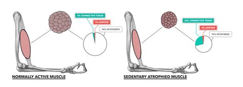 CrossFit | Muscle Basics, Part 4: Atrophy & Sarcopenia