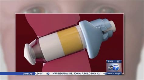 New device offers breakthrough sinusitis treatment - ABC7 Chicago