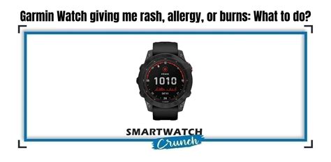 Garmin Watch giving me Rash, Allergy, or Burns: What to do? (FR, Fenix ...