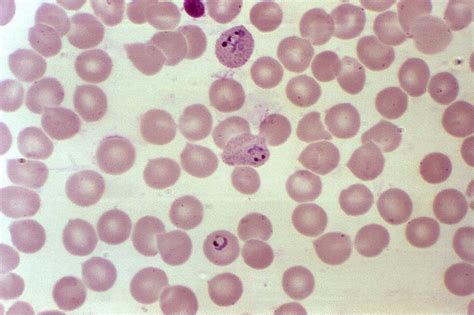 Free picture: magnified, 1000x, blood smear, photomicrograph, erythrocytes, developing ...
