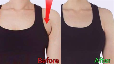 10 Most Effective Exercises to Get Rid of Underarm Fat & Home Remedies