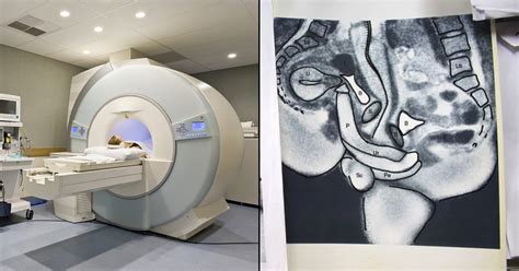 A Couple Had Sex In An MRI Machine, All For Science - ScoopWhoop