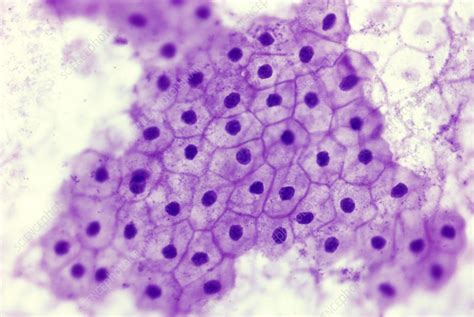 Simple squamous epithelium - Stock Image - G450/0098 - Science Photo ...