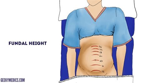 Obstetric Abdominal Examination - OSCE Guide | Geeky Medics