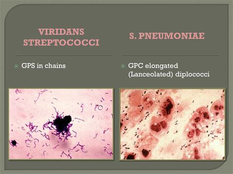 PPT - STREPTOCOCCUS PowerPoint Presentation, free download - ID:2327955