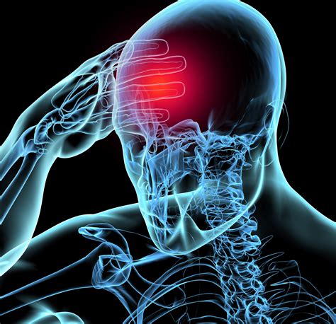 Concussion: Symptoms, Causes, Risk factors and Complications