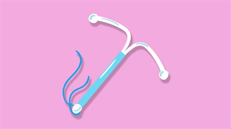 Contraceptive Coil Guide | LloydsPharmacy Online Doctor UK