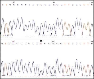 DNA resequencing, performed in the forward and reverse (not shown)... | Download Scientific Diagram