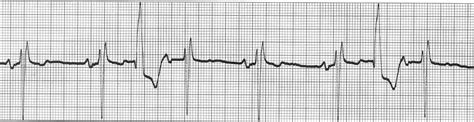 ECG Learning Center - An introduction to clinical electrocardiography