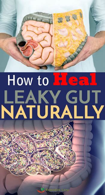 How to Heal Leaky Gut Naturally - Remedies Lore