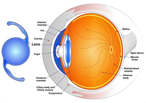 Intraocular Lens (IOLs) - Uses, Types, Cost, Results, etc. | Eye health ...