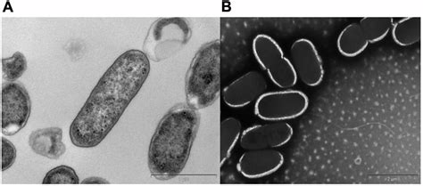 | Transmission electron micrographs of Citrobacter sp. KVM11. Bacterial... | Download Scientific ...