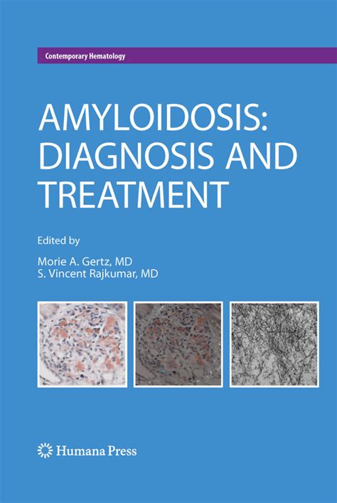 (PDF) Renal Amyloidosis