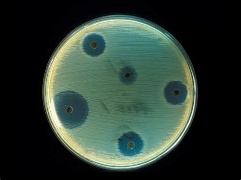 Module-2: Antibiosis- 5 Sem B.Sc Microbiology-Environmental ...