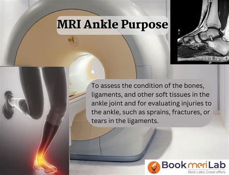 MRI Ankle: Price, Purpose, Procedure & Results [2024] • Bookmerilab