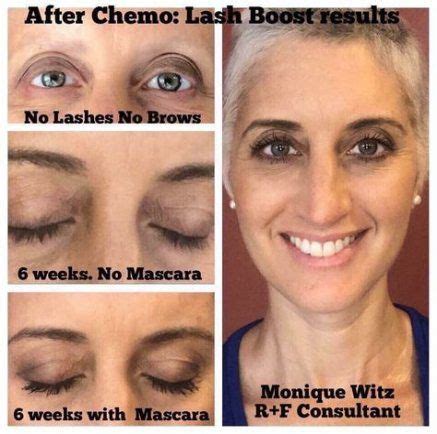 Best hair growth after chemo skin care 47+ Ideas | Hair growth after chemo, Lash boost, Lashes