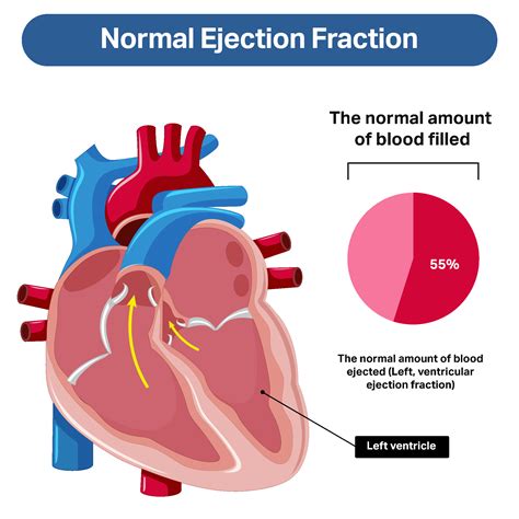 What Is Ejection Fraction Of Heart