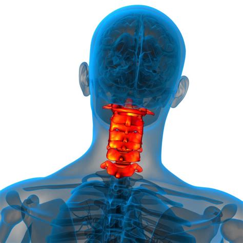 Posterior Cervical Fusion Surgery | Spine Surgeon in Woodbury, MN