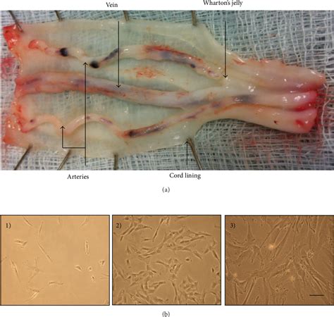 Human Umbilical Cord