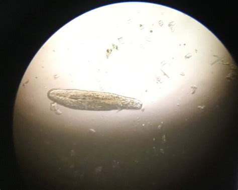 Identifying Pond Water Microorganisms as Bioindicators - Science By Sinai