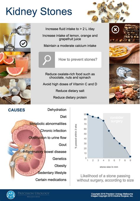 Precision Urology Melbourne | Kidney Stones