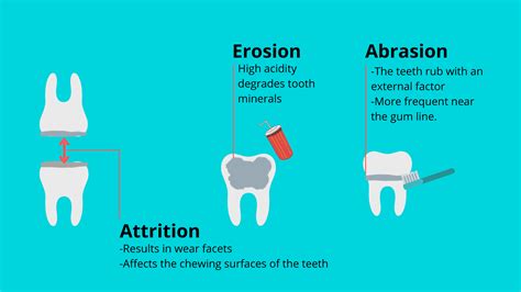 How do wear facets occur, and how to deal with them?