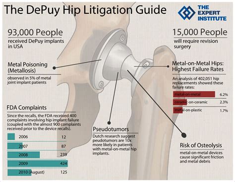 The DePuy Hip Litigation Guide from The Expert Institute Hip Implants ...