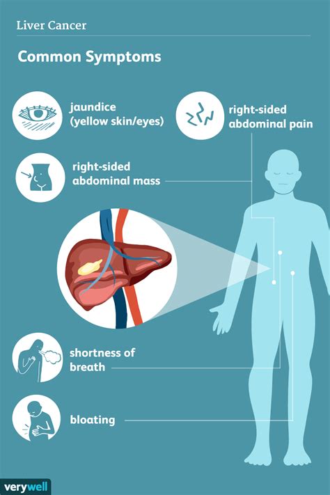 Liver Cancer: Signs, Symptoms, and Complications