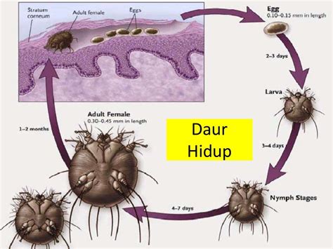 Penyakit scabies pada ternak