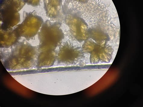 Uric Acid Crystals in Urine - MaryjaneqoEnglish