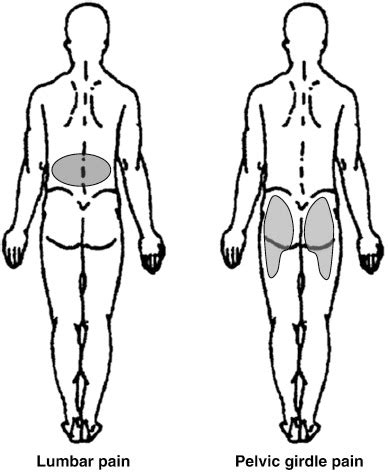 Pelvic Girdle Pain - Physiotherapy Victoria BC