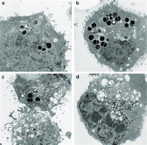 Electron micrographs of keratinocyte HaCaT cells that were infected ...