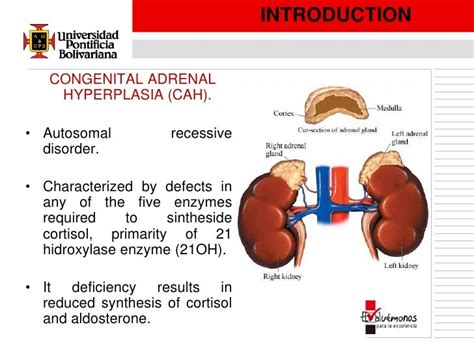 Congenital Adrenal Hyperplasia (CAH)