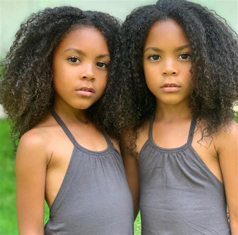 One Black and One White Twins - What Do They Look Like 18 Years Later? | Gadgetheory | Page 2