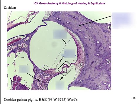 Histology of cochlea Diagram | Quizlet