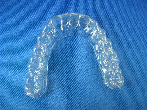 A Guide to Different Types of Dental Retainers | Top Dentist Reviews