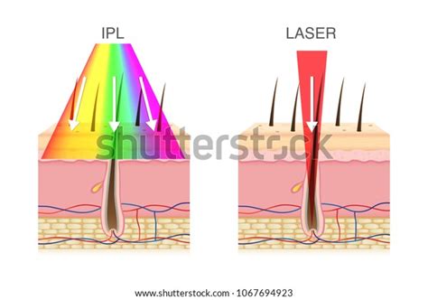 15 Ipl Compare Images, Stock Photos & Vectors | Shutterstock