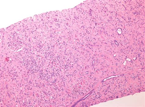 Histology of the renal cortex. The interstitium contains a large number ...