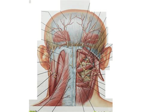 suboccipital triangle with nerves Quiz