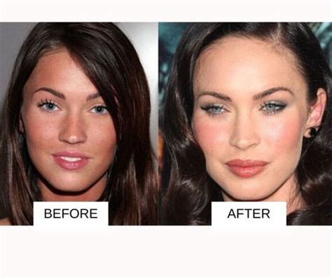 25 Most Popular Celebrities With Lip Fillers: Before And After With Images | Fabbon