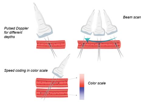 Ultrasound Physics - Medical Professionals