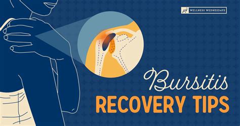 Bursitis Recovery Tips | Exercises and Stretches for Bursitis Relief ...