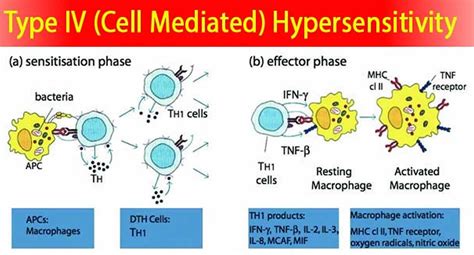 Delayed hypersensitivity reaction causes, symptoms, diagnosis & treatment